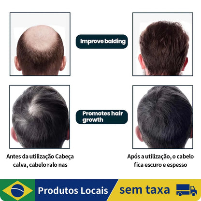 Solução para cuidados com cabelo e barba 60ml